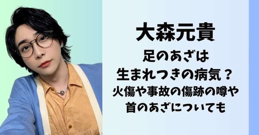 大森元貴の足のあざは生まれつきの病気？火傷や事故の傷跡の噂や首のあざについても